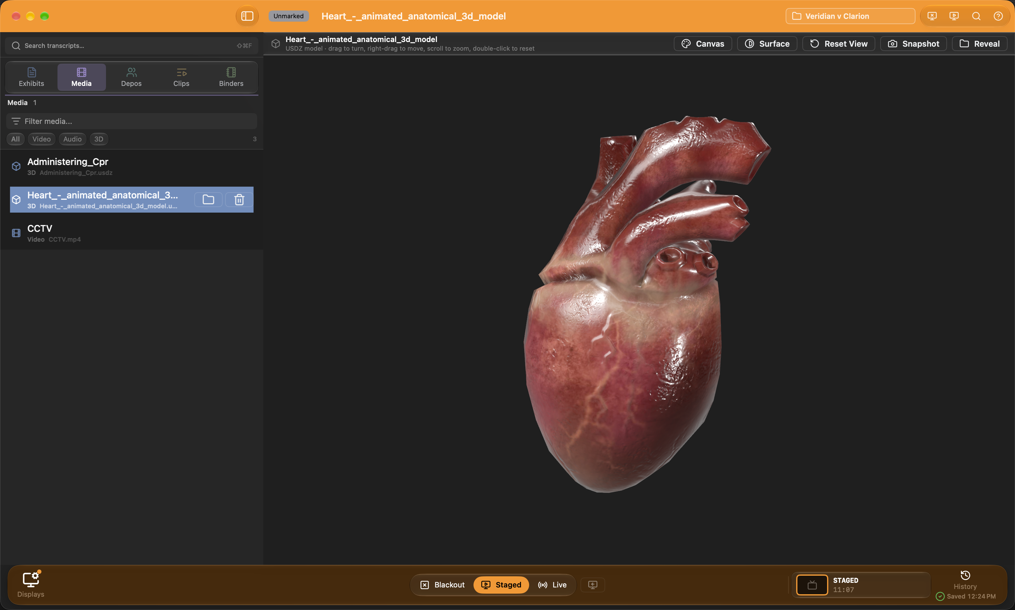 A 3D model of a human heart staged in the workspace, with Canvas, Surface, Reset View, Snapshot, and Reveal above it.